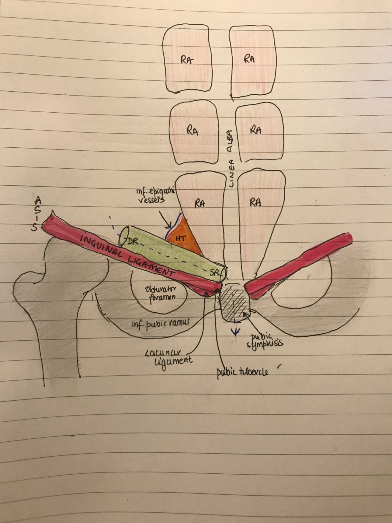 Inguinal Hernia in Infancy and Children | IntechOpen